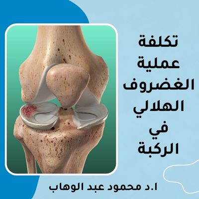 تكلفة عملية الغضروف الهلالي