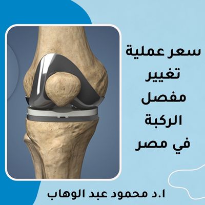 سعر عملية تغيير مفصل الركبة في مصر
