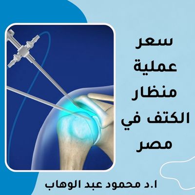 سعر عملية منظار الكتف في مصر 2025