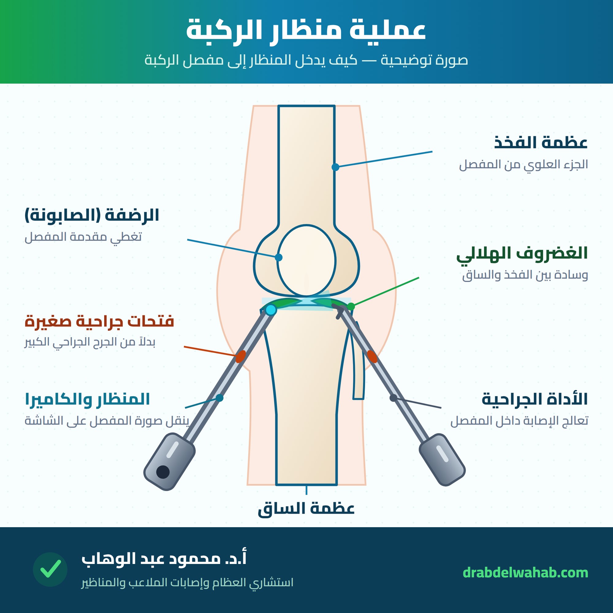 إنفوجراف عملية منظار الركبة يوضح دخول المنظار والأدوات الجراحية إلى مفصل الركبة